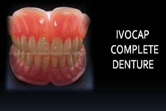 Ivocap Complete Denture